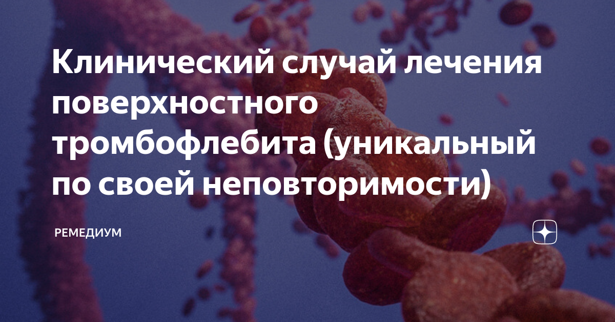 Униканльный клинический случай лечения поверхностного тромбофлебита