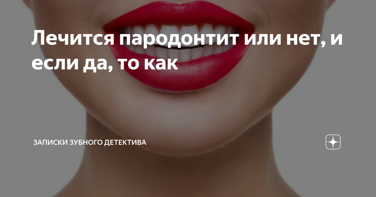 Лечится пародонтит или нет, и если да, то как | записки зубного ...