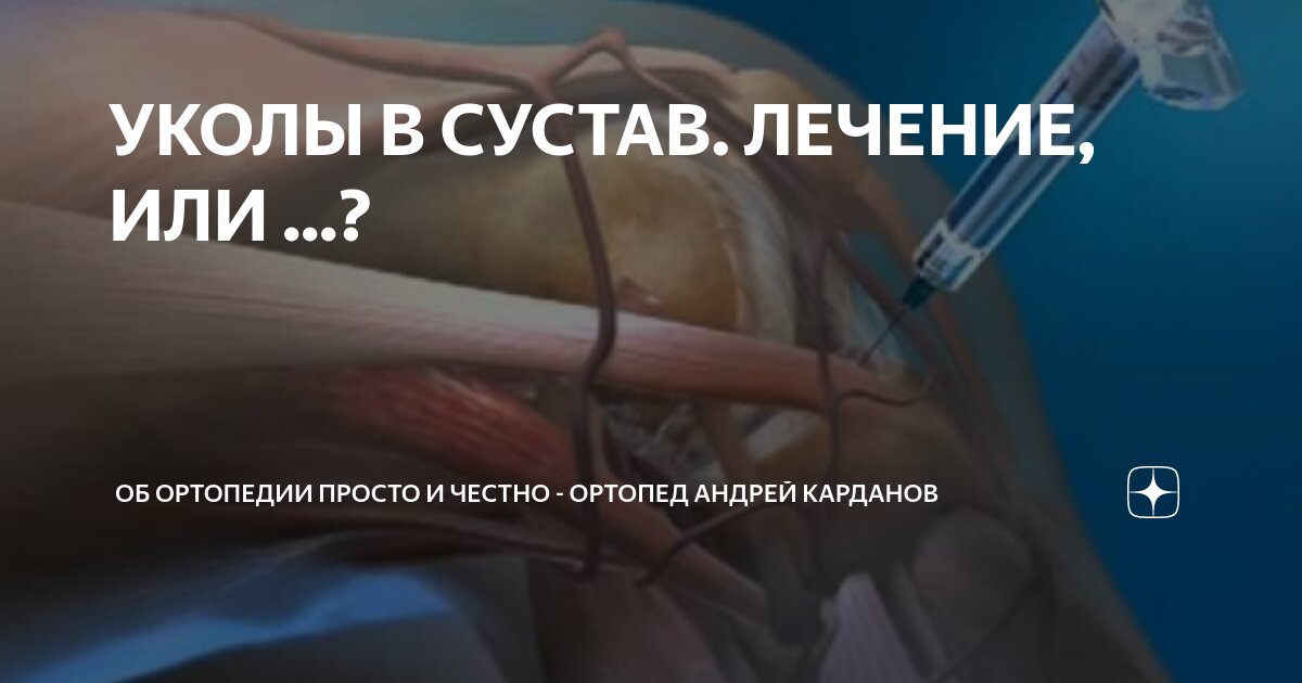 УКОЛЫ В СУСТАВ. ЛЕЧЕНИЕ, ИЛИ ...? | О СУСТАВАХ ПРОСТО И ЧЕСТНО ...