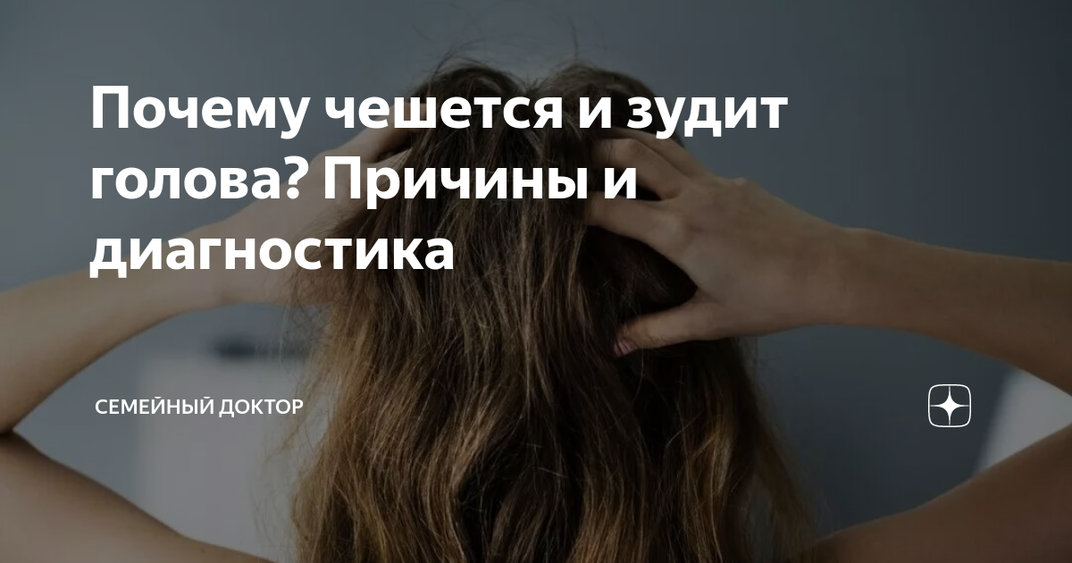 почему чешется голова и много перхоти