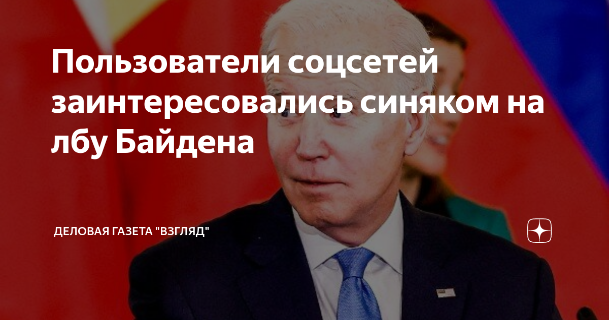 с синяком на работу