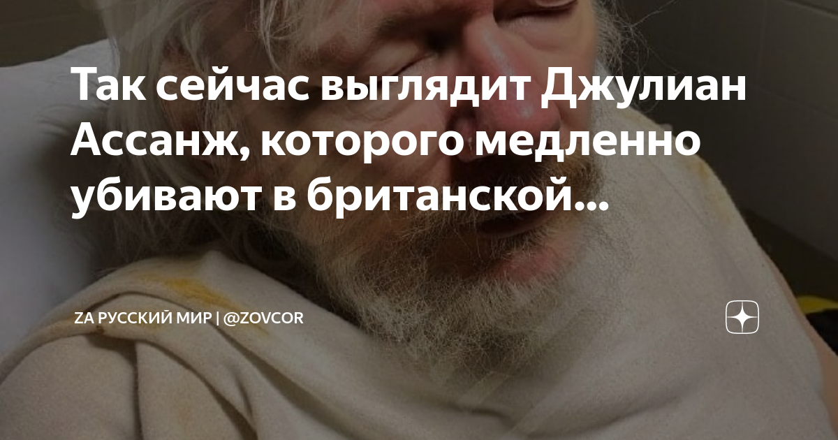 Так сейчас выглядит Джулиан Ассанж, которого медленно убивают в британской. Za Р