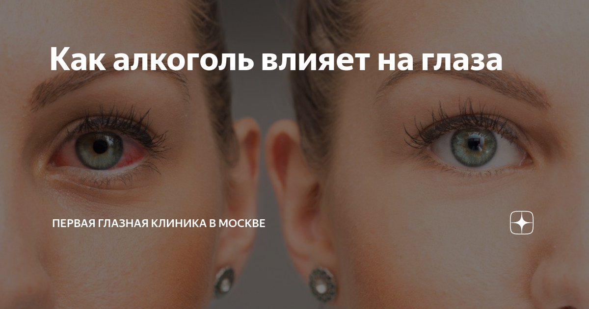 Как алкоголь влияет на глаза | Первая глазная клиника в Москве | Дзен