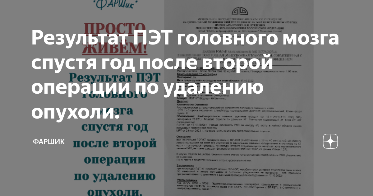 сколько живут после операции по удалению опухоли головного мозга