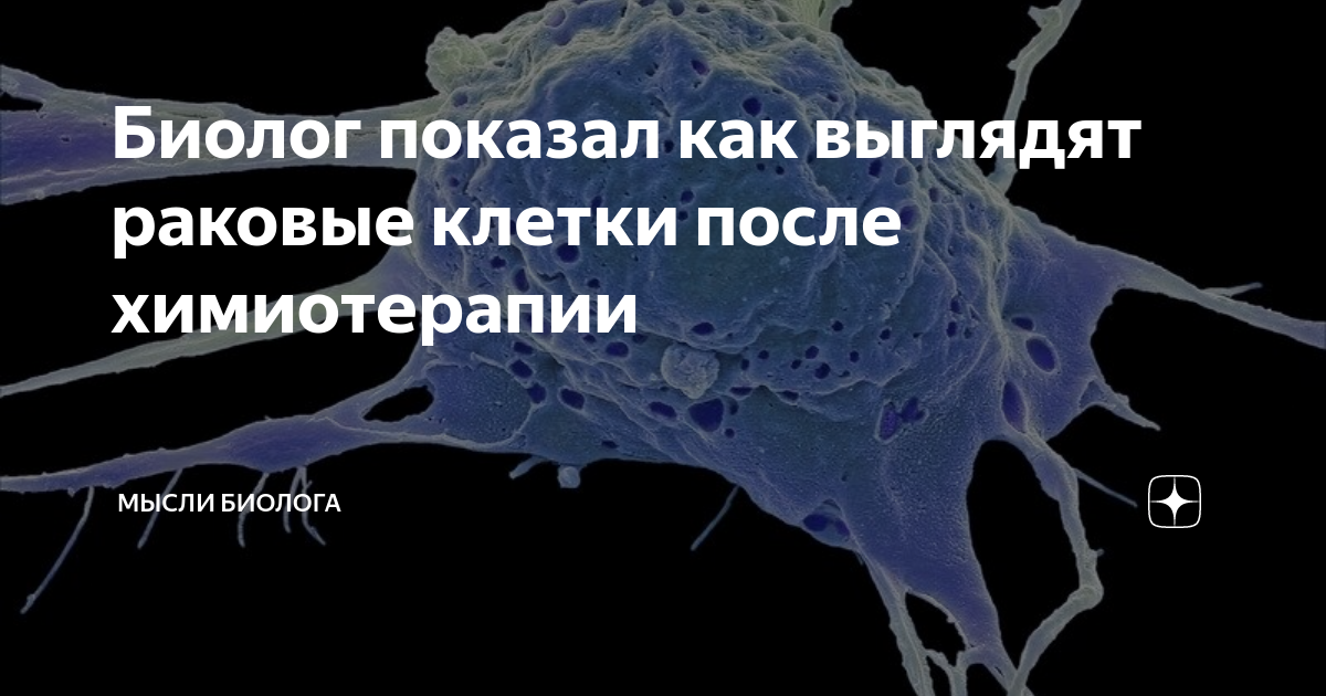 Биолог показал как выглядят раковые клетки после химиотерапии | Мысли ...