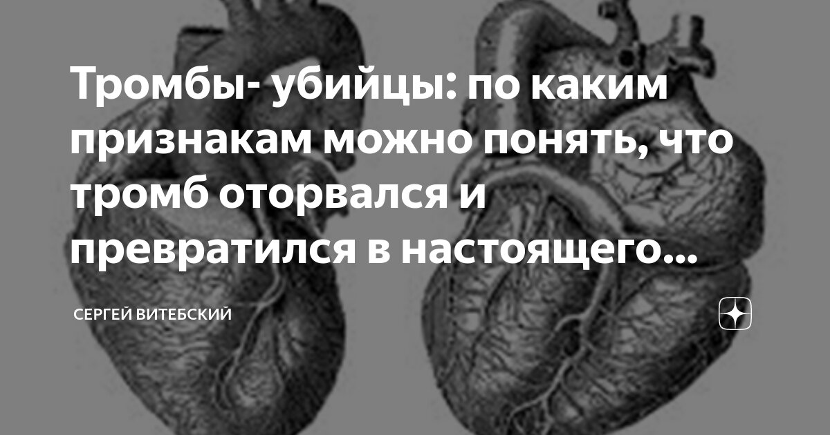 Тромбы- убийцы: по каким признакам можно понять, что тромб оторвался и ...
