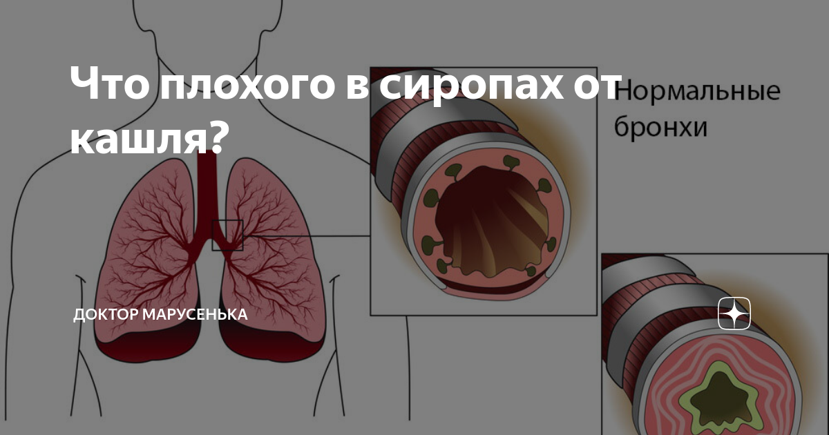 Влажный кашель у ребенка — Причины, симптомы и лечение кашля с мокротой у детей | AGU-Baby