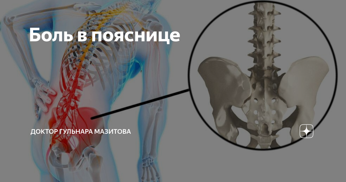 Если болит поясница к какому врачу. Если болит поясница к какому врачу. Боль в пояснице. Спина болит что надо делать. Болит спина к какому врачу.