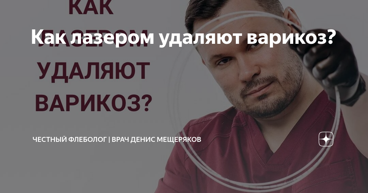 Как лазером удаляют варикоз? | Флеболог Москва | врач Денис Мещеряков ...