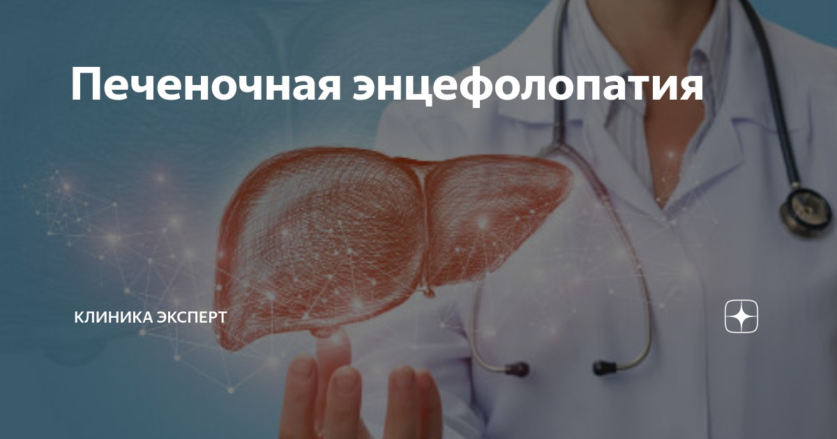 Печеночная энцефолопатия | Клиника ЭКСПЕРТ - Гастро-гепатоцентр | Дзен
