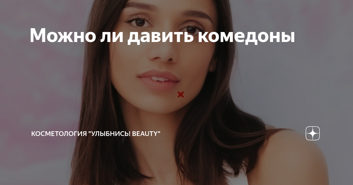 Можно ли давить комедоны | Косметология "БьютиНега" | Дзен