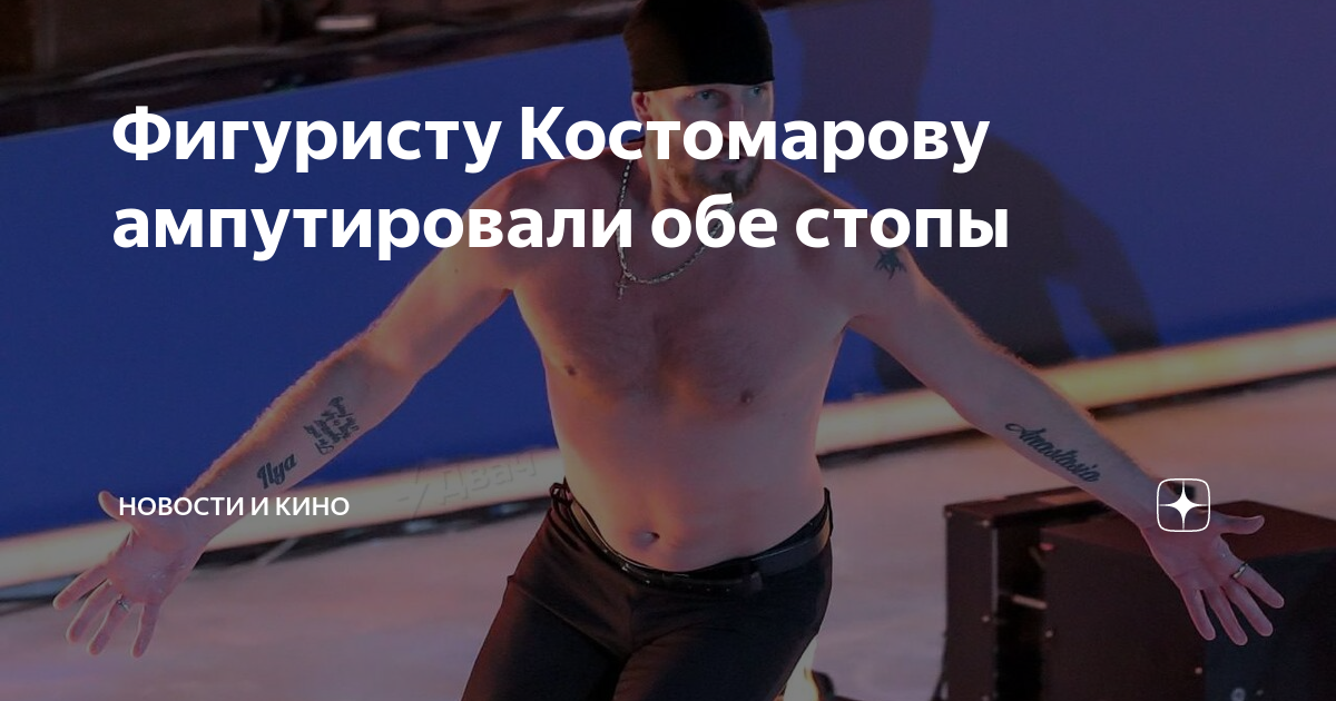 Костомаров руки ноги