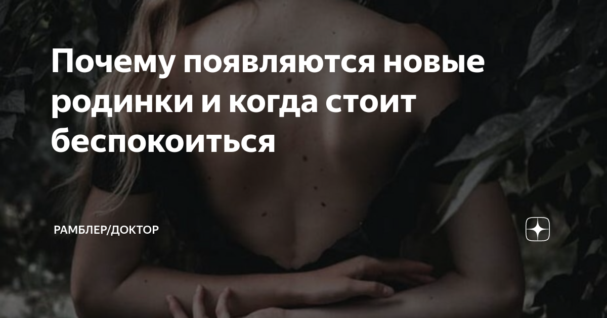 Как правильно загорать и что делать с родинками