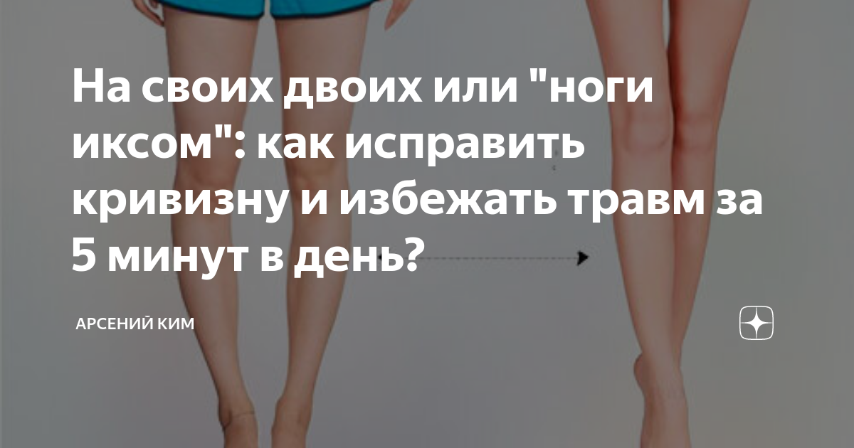 Как исправить ноги х Как исправить ноги х