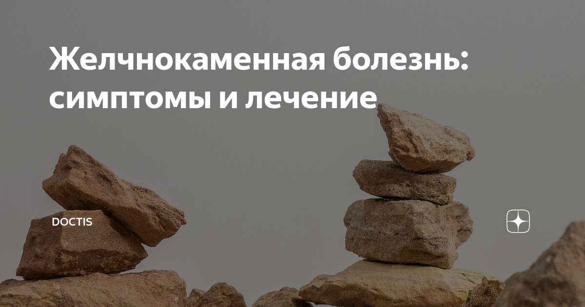 Желчнокаменная болезнь: симптомы и лечение | Doctis | Дзен