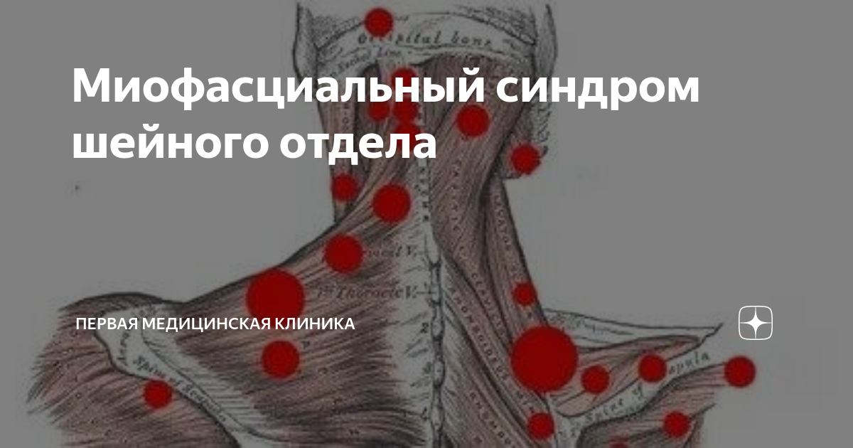 шейная мышечная боль