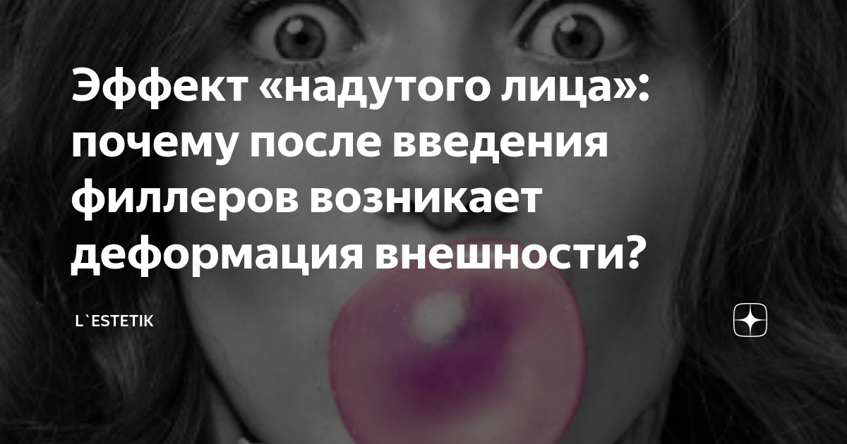 Эффект «надутого лица»: почему после введения филлеров возникает ...