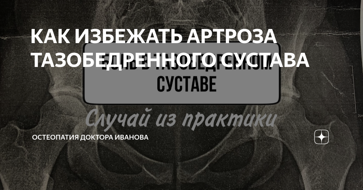КАК ИЗБЕЖАТЬ АРТРОЗА ТАЗОБЕДРЕННОГО СУСТАВА | Остеопатия доктора ...