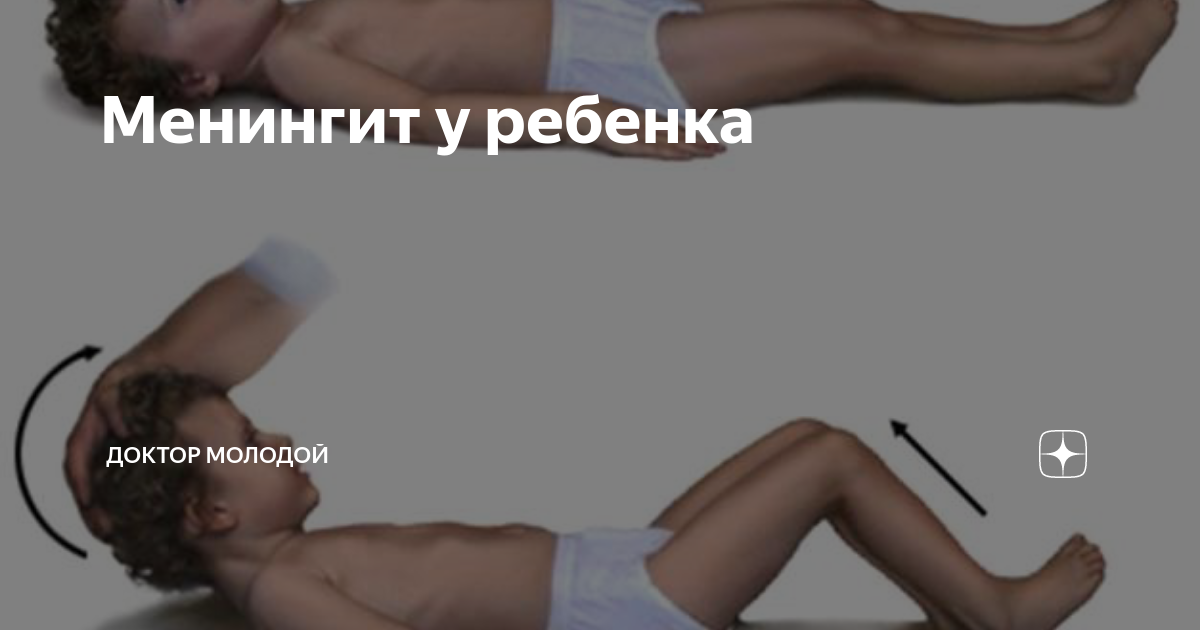 Менингит у ребенка | Доктор Молодой | Дзен