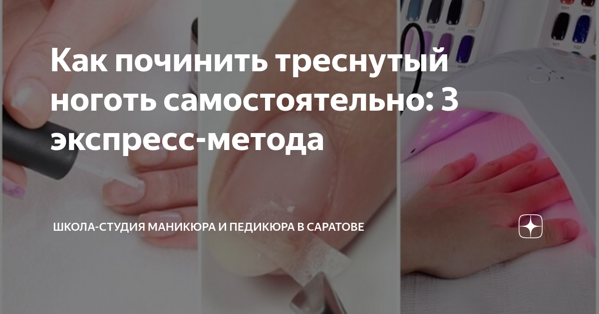 Что делать, если сломался ноготь, и как его восстановить?