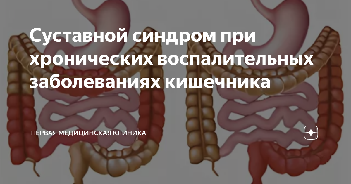 хронические заболевания кишечника студфайл