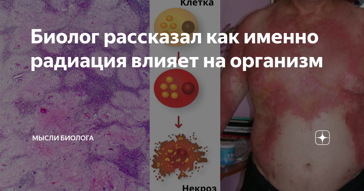 Биолог рассказал как именно радиация влияет на организм | Мысли биолога ...