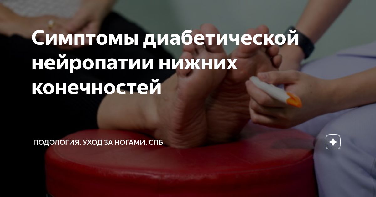 сколько живут после ампутации ноги при сахарном диабете