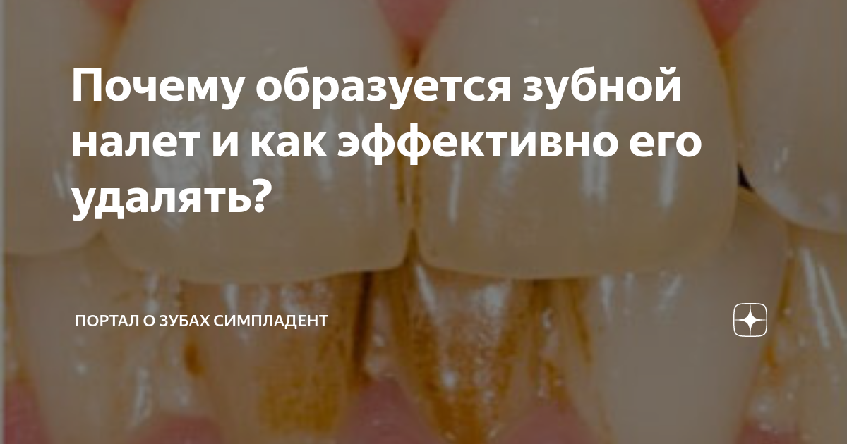 Почему образуется зубной налет и как эффективно его удалять? | Портал о ...