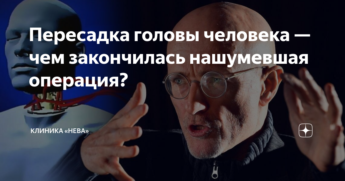 Пересадка головы человека — чем закончилась нашумевшая операция ...