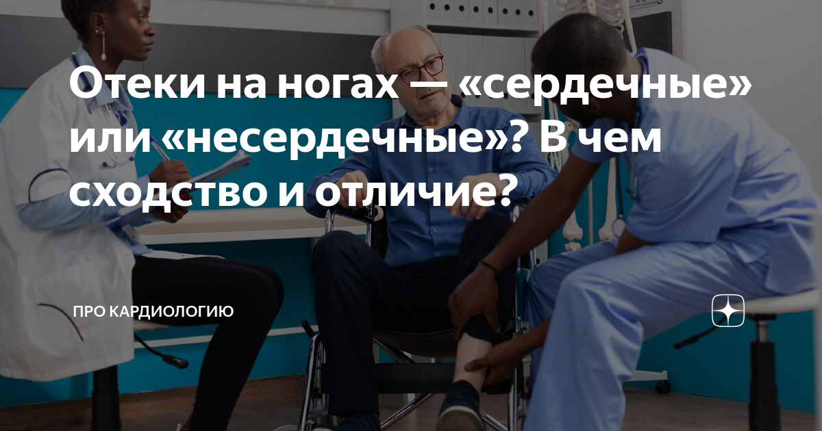 Отеки на ногах — «сердечные» или «несердечные»? В чем сходство и ...