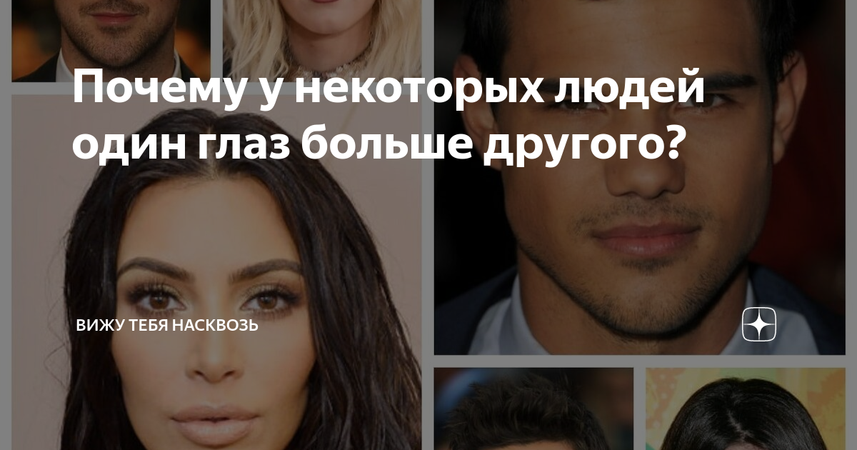 Анизокория: что вызывает разный размер зрачков?