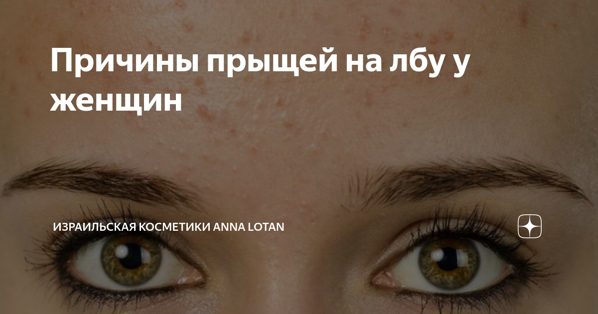 большой прыщ на лбу примета