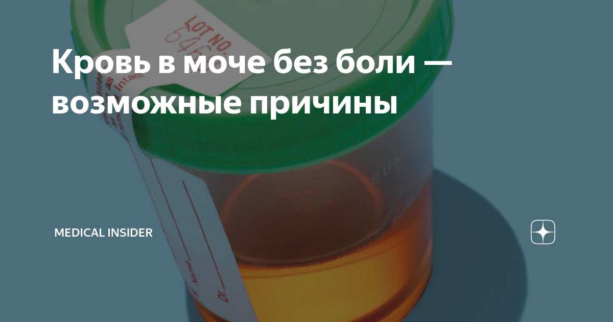 кровь в моче у мужчин без боли