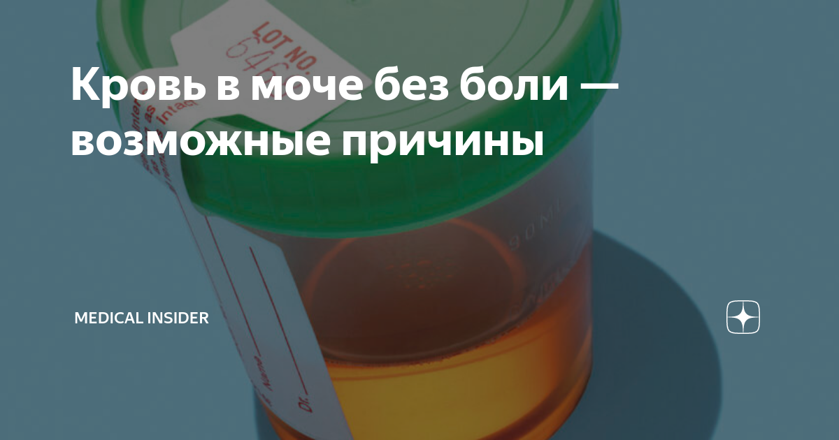 Кровь при мочеиспускании у женщин: кровяные выделения, сгустки крови - лечение