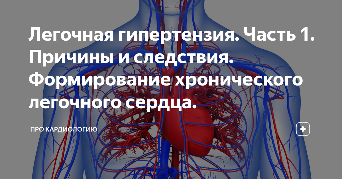 Легочная гипертензия прогноз. Легочная гипертензия прогноз
