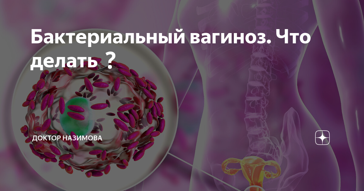 Бактериальный вагиноз по утвержденным клиническим рекомендациям 2022