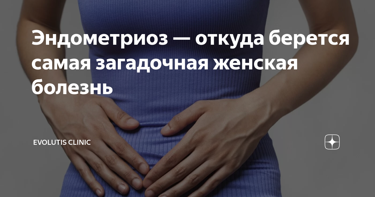 Эндометриоз — откуда берется самая загадочная женская болезнь ...