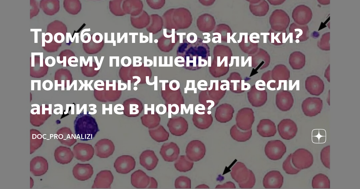 Анализ крови на тромбоциты