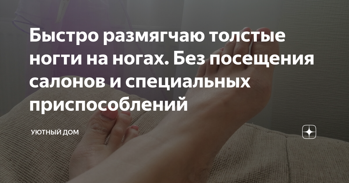 Быстро размягчаю толстые ногти на ногах. Без посещения салонов и ...