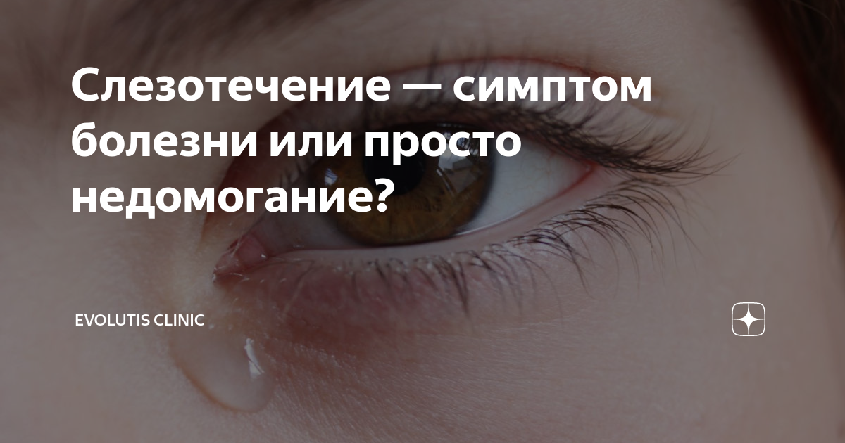 Слезотечение — симптом болезни или просто недомогание? | Evolutis ...
