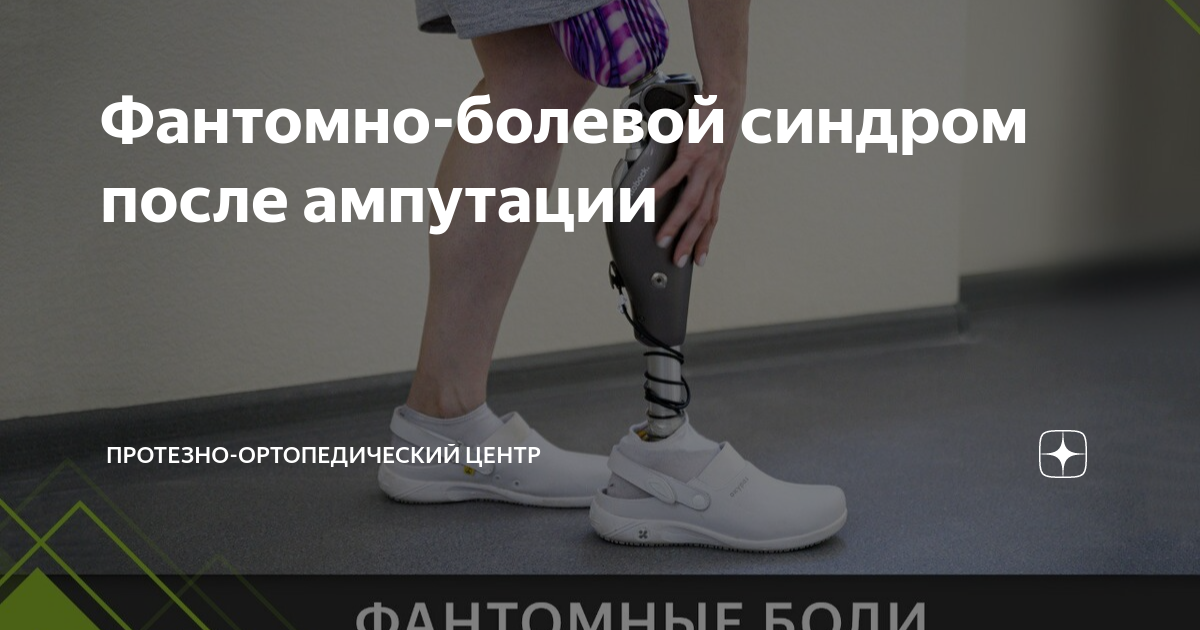 Фантомно-болевой синдром после ампутации | Протезно-ортопедический ...