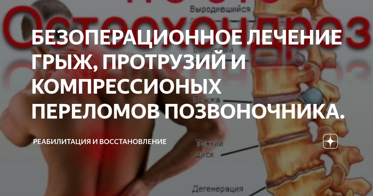 Поясничная грыжа лечение отзывы форум. Грыжа позвоночника. смещение позвонка.