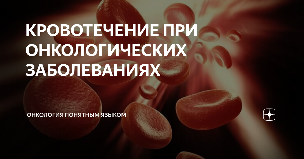 обильное кровотечение после отмены ок