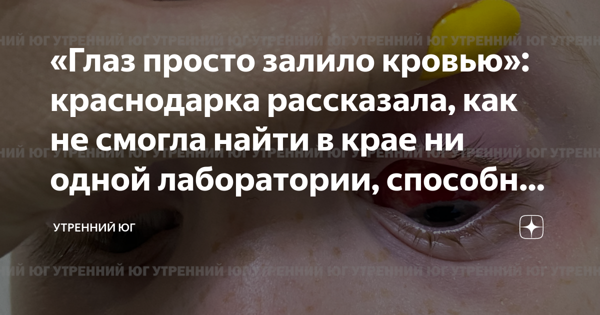 «Глаз просто залило кровью»: краснодарка рассказала, как не смогла ...
