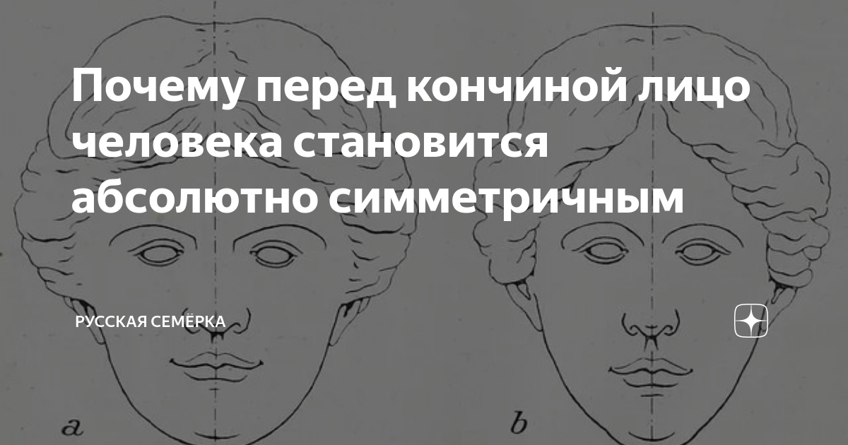 «Маска Гиппократа»: как меняется лицо человека перед смертью - Русская семерка
