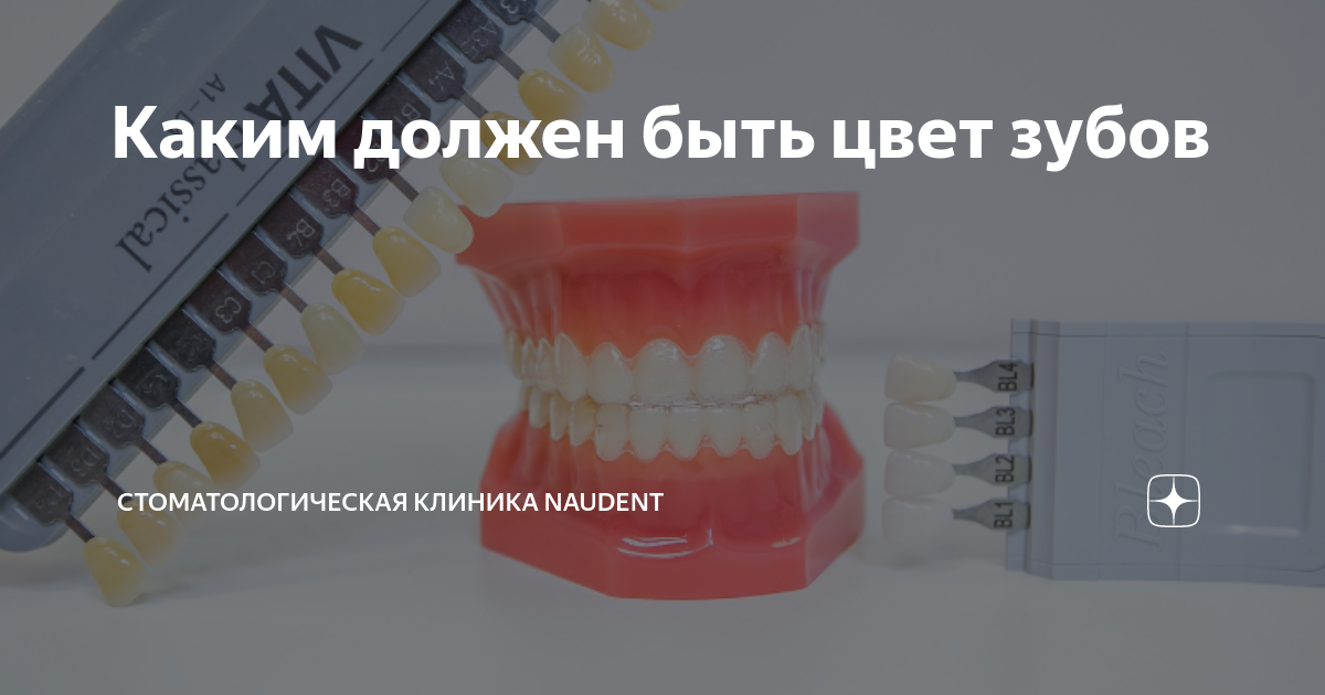 Каким должен быть цвет зубов | Стоматологическая клиника Naudent | Дзен