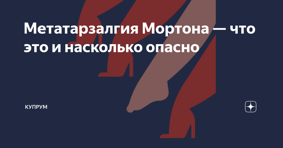 Метатарзалгия Мортона — что это и насколько опасно | Купрум | Дзен