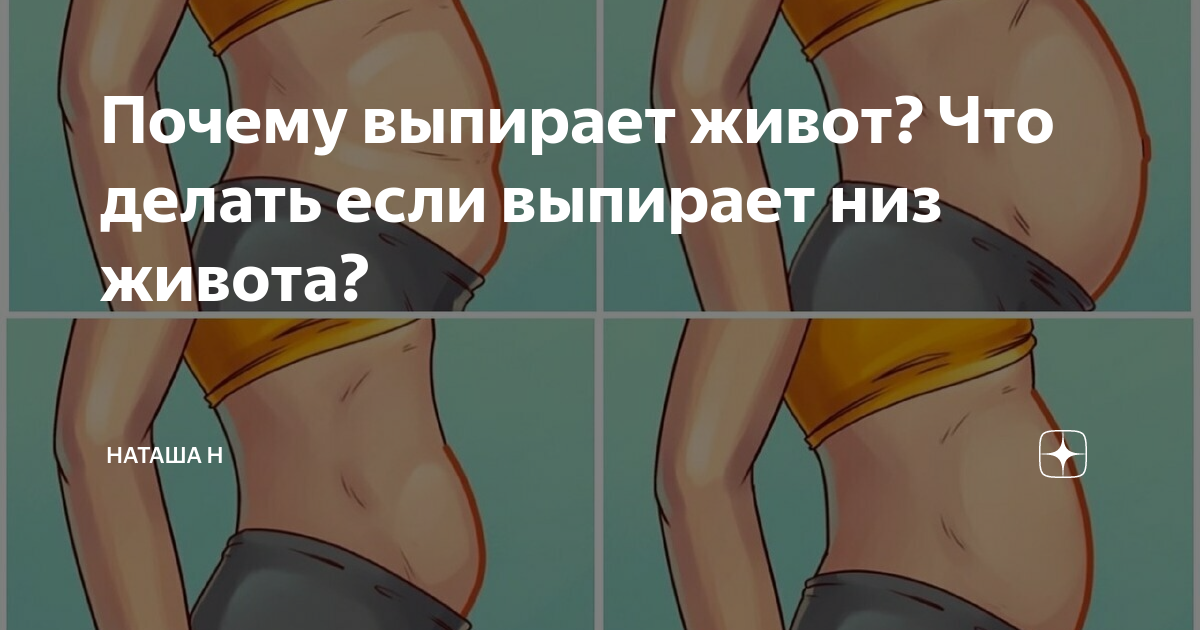 Почему выпирает низ живота и как это исправить: мнение врача - Чемпионат