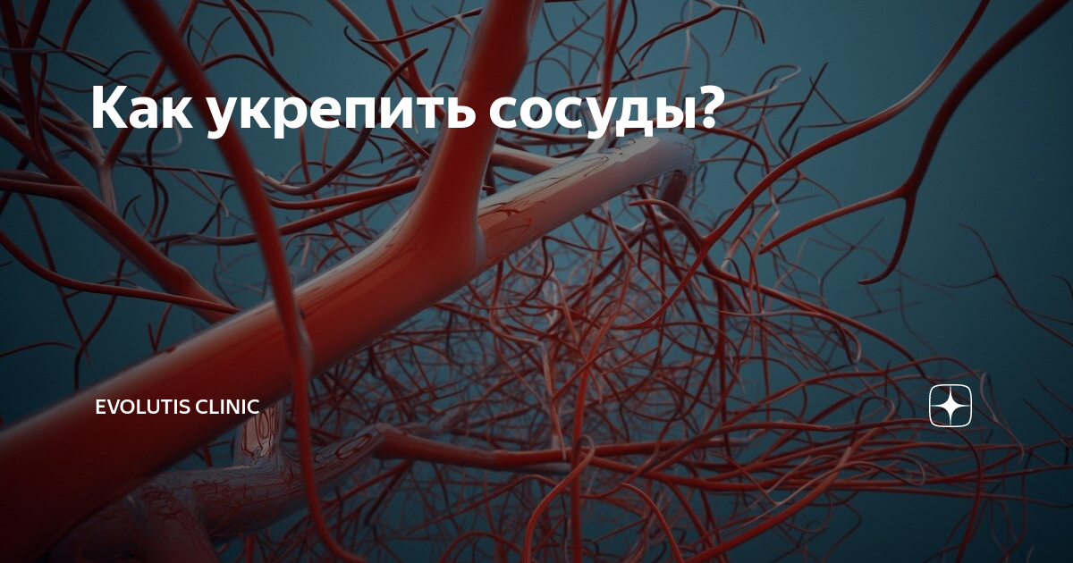 Укрепление кровеносных сосудов. Укрепить кровеносные сосуды. Что укрепляет стенки сосудов. Крепкие сосуды.