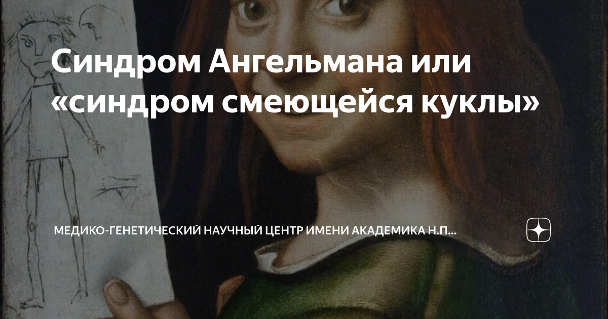 Синдром Ангельмана или «синдром смеющейся куклы» | Медико-генетический ...